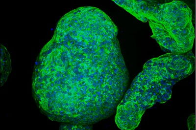 慢病界 crispr 荧光蛋白 光遗传学 高端生物技术源自大自然的 工具箱